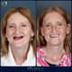 Slider image (9) Soho Dental Clinic – All-on-X & Dental Implant Center